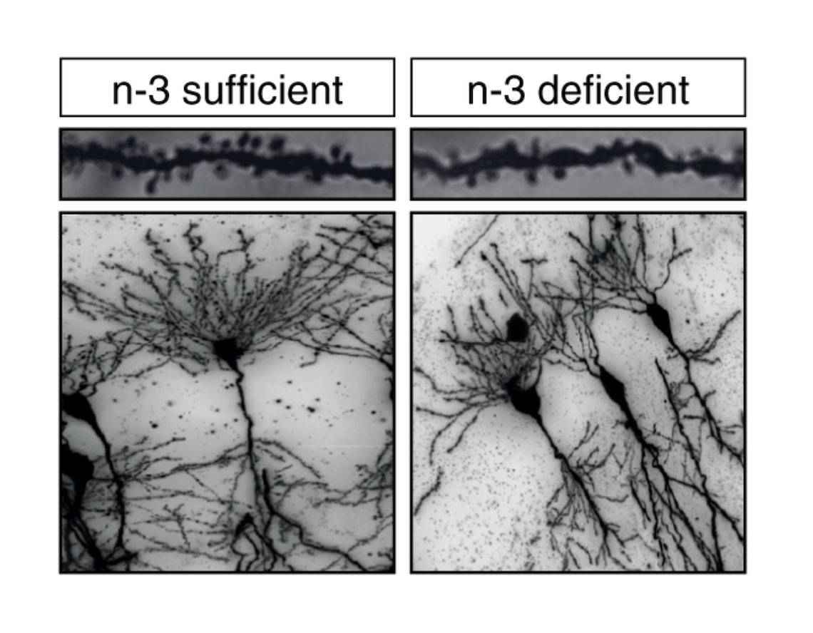Microscopic images of dendrites and the pruning of hippocampal neurons from Omega 3 sufficient (left) and Omega 3 deficient (right) mice, courtesy of Nature Communications
